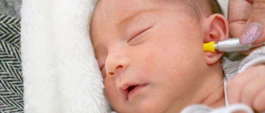 Symbolbild: Ein Neugeborenes wird mit der Hörscreening Methode untersucht