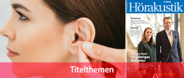 IdO-Anpassung: Das Zusammenspiel von Abdruck, Anatomie und Anpassstrategie